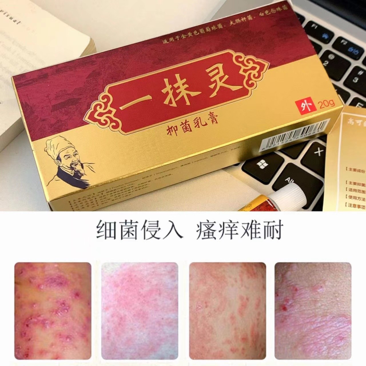 【极速发货】正品高可医一抹灵抑菌草本乳膏20g/盒