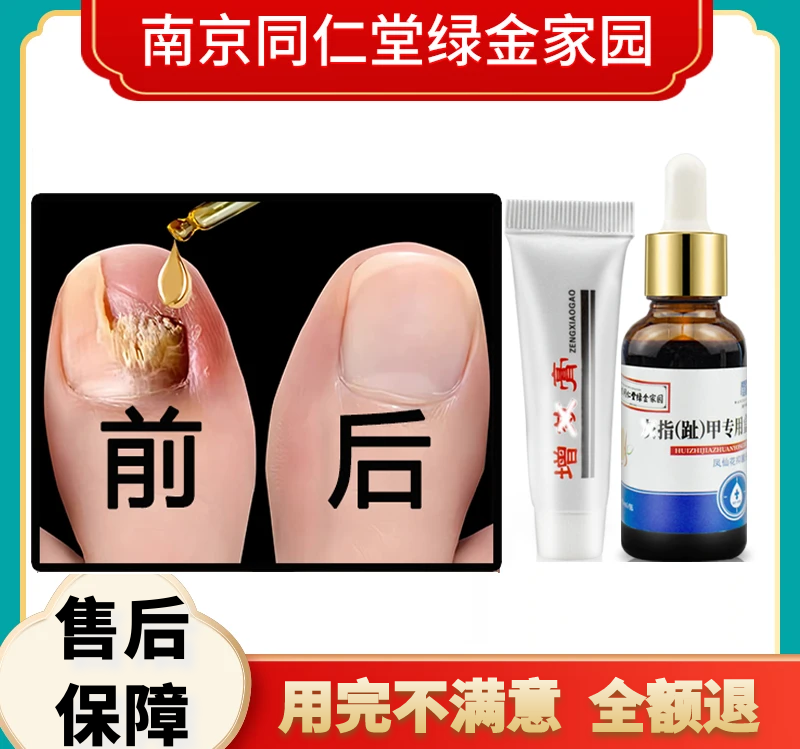 灰（趾）指甲液护理膏专用套盒修 复厚 空 变色凹凸草本