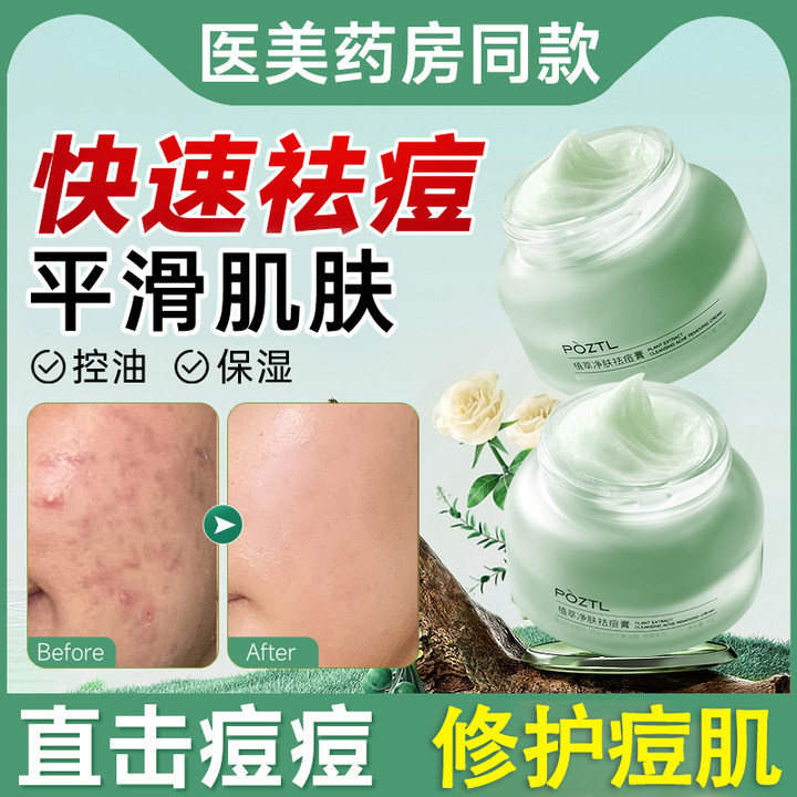 祛痘膏去痘修护膏淡化痘痘凹洞控油保湿印坑不刺激男士女学生专用
