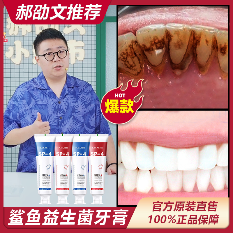 【阿文推荐】SP-4鲨鱼酵素牙膏亮白清新口气护龈清洁牙齿洁白益生菌