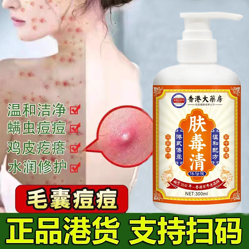马拉色菌毛囊洗液头部脸部背胸痘痘皮焱脓包皮肤止痒抑菌沐浴露