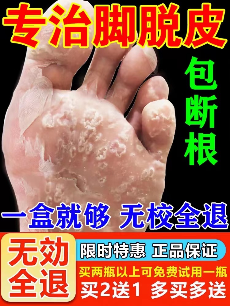 脚脱皮起泡去死皮专用膏脚掌脱皮脚底脚心掉皮干燥干裂抑菌软膏