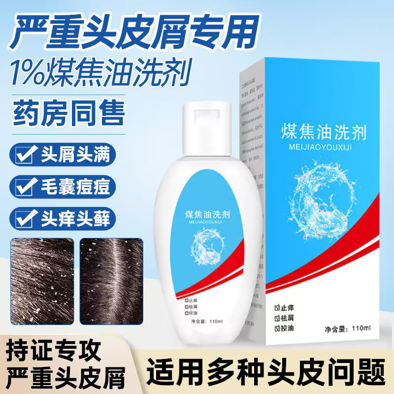 【粉丝福利】煤焦油洗剂1%去屑止痒洗发水清爽保湿除螨控油抑菌