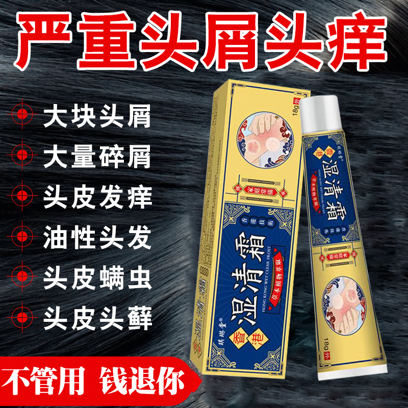 【头皮痒的抓出血】头屑除螨毛囊剪发虫发红痘痘头痒止痒抑菌湿清霜