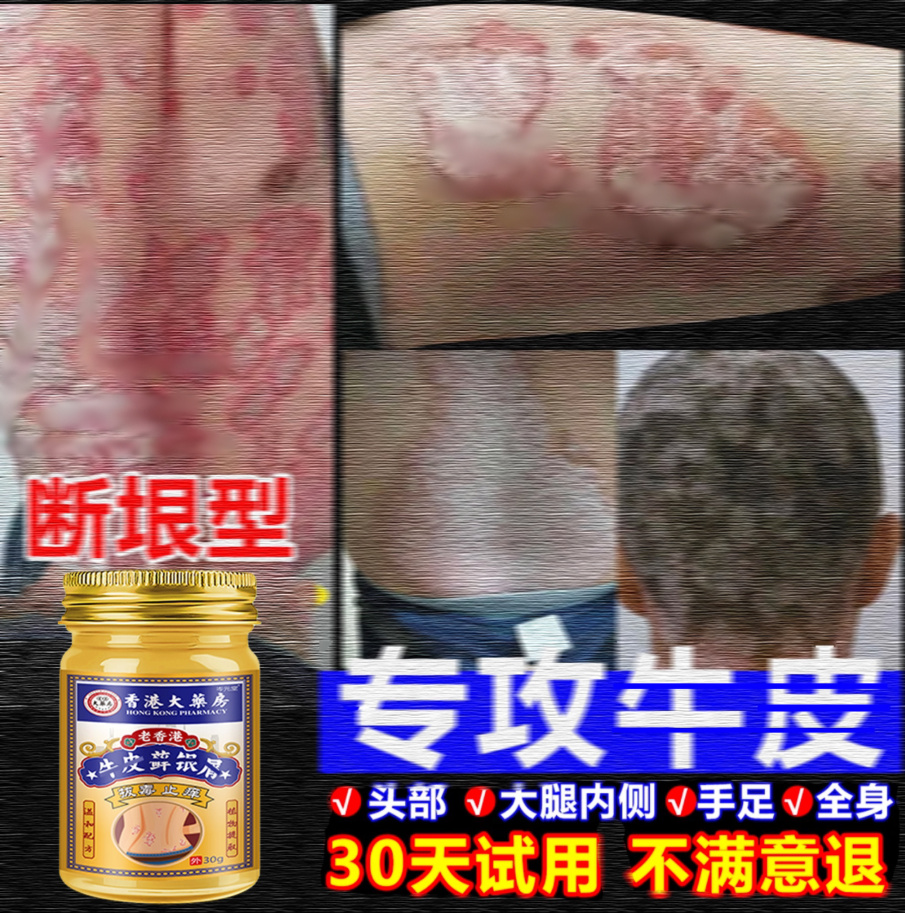 【牛皮专用】牛痒皮肤顽固手足体股红点大腿内侧全身可用止痒乳膏
