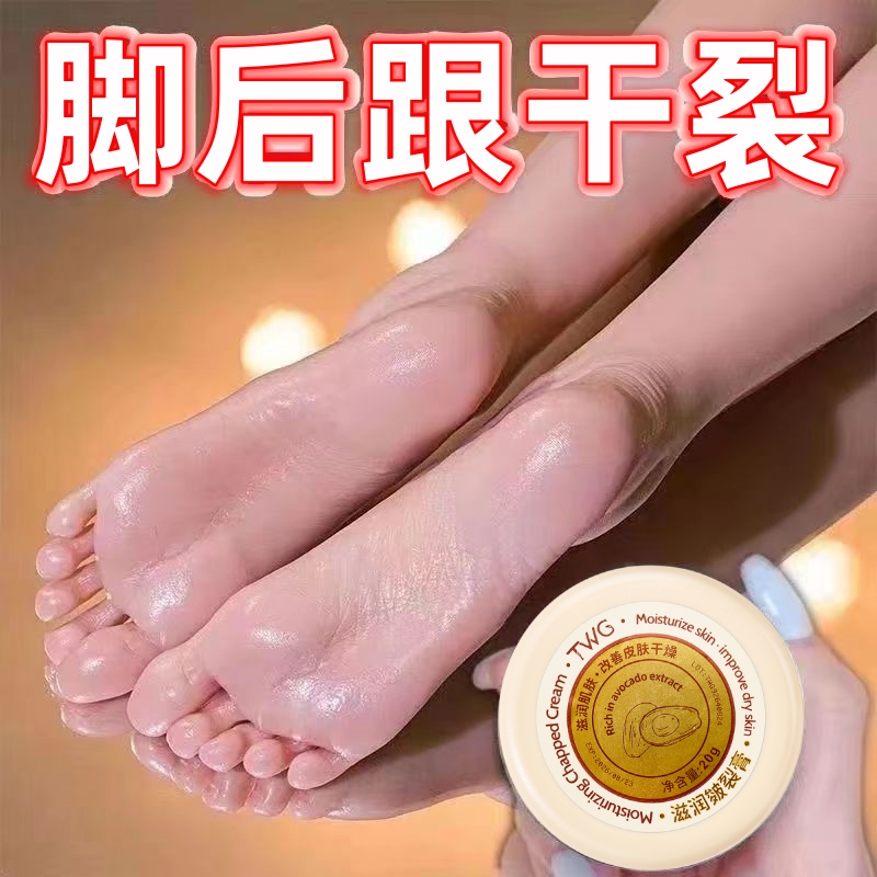 TWG脚后跟干裂起硬皮皲裂膏保湿霜防干防裂手足粗糙润足皴裂膏ww