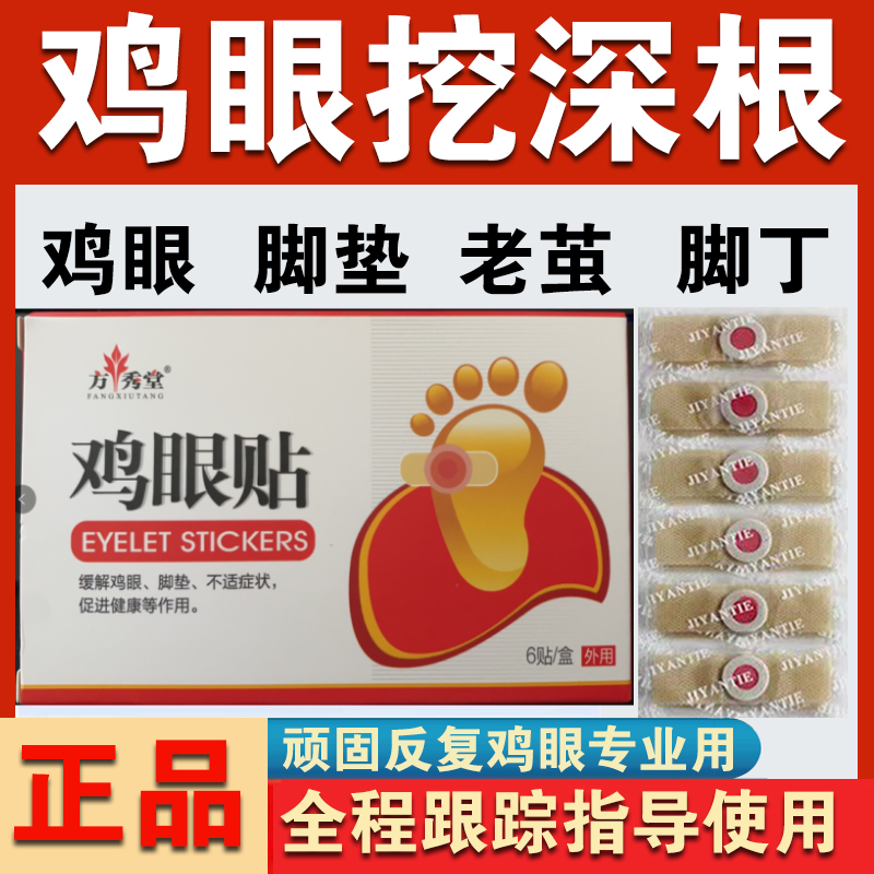 正品脚眼贴脚丫鸡眼贴膏老厚茧肉刺膏贴脚垫老死皮硬皮去茧手茧