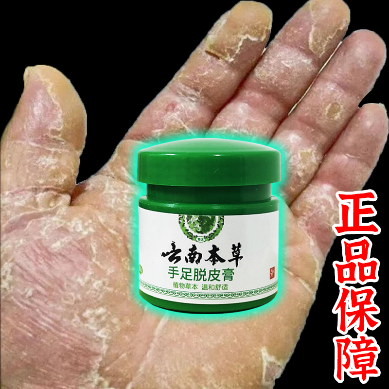 云南本草膏手足脱皮膏草本精粹外用手脚部脱皮干裂抑菌止痒干软膏